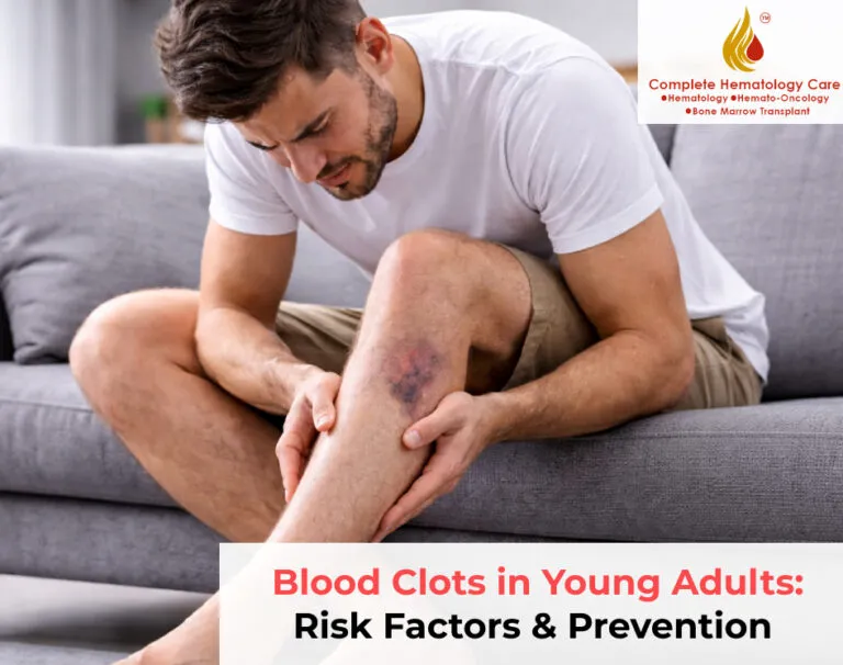 Blood Clots in Young Adults: Risk Factors & Prevention