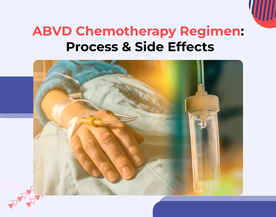 ABVD Chemotherapy Regimen: Process & Side Effects
