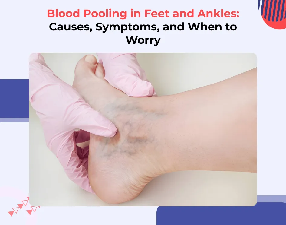 Blood Pooling in Feet and Ankles: Causes, Symptoms, and When to Worry