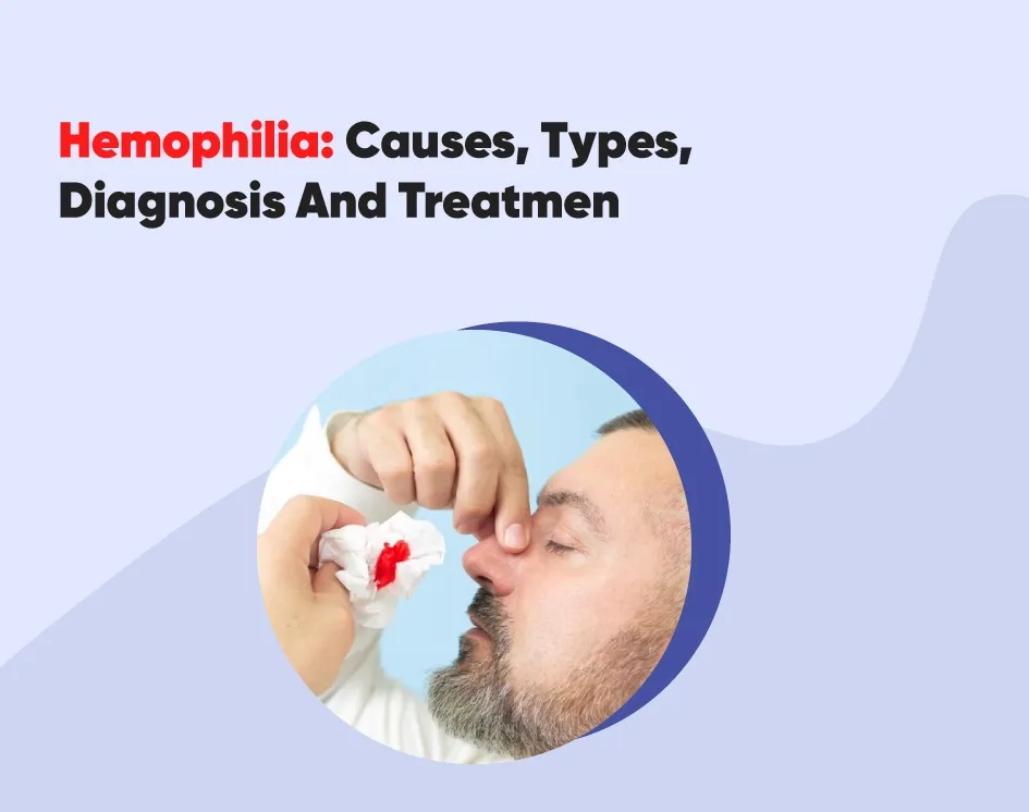 Hemophilia: Causes, Types, Diagnosis And Treatment