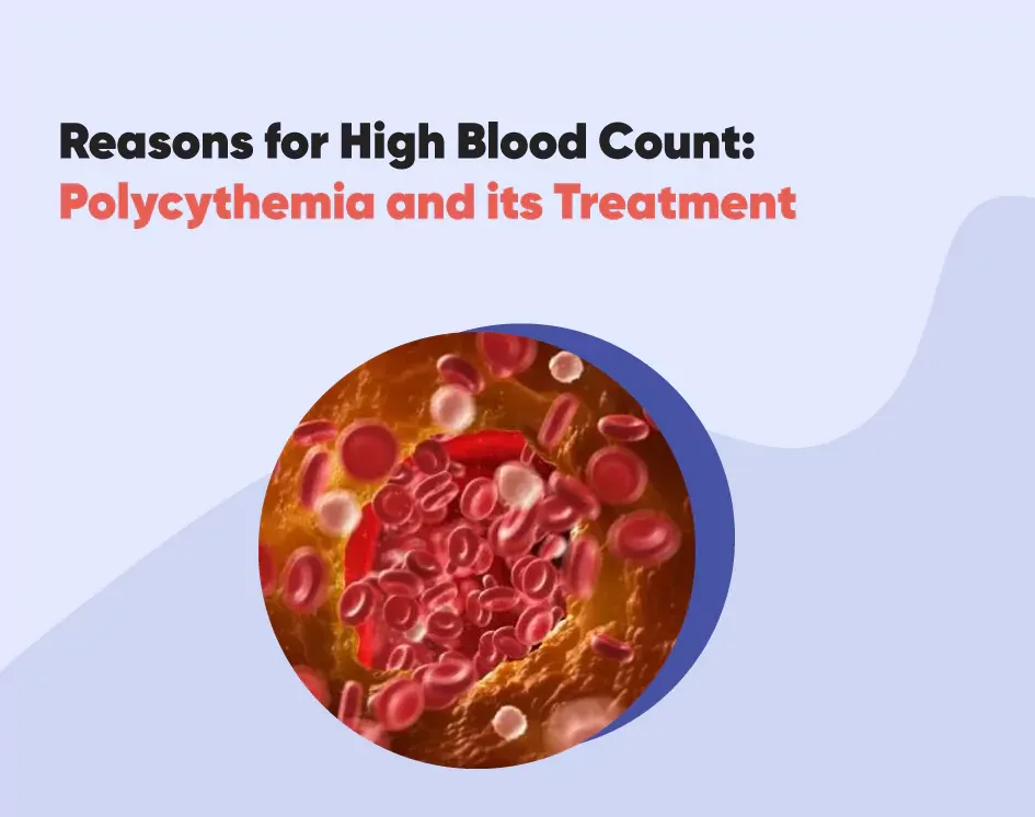 Reasons for High Blood Count: Polycythemia and its Treatment